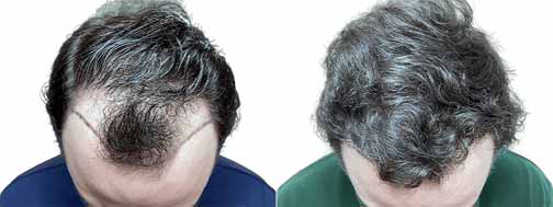 معایب و مزایا مایکروپوینت