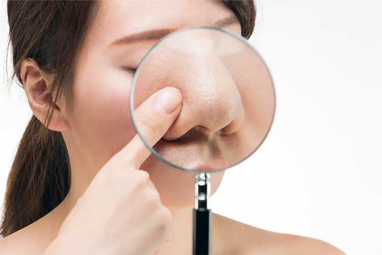 بهترین سن برای عمل بینی گوشتی