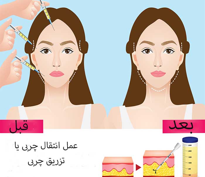جدیدترین عمل ها | عمل های زیبایی