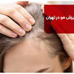 ریزش مو