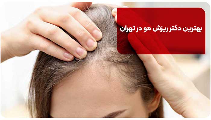 بهترین دکتر ریزش مو در تهران