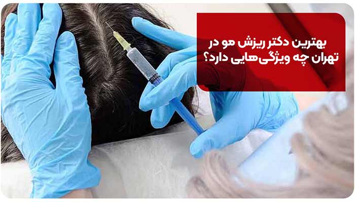ریزش مو