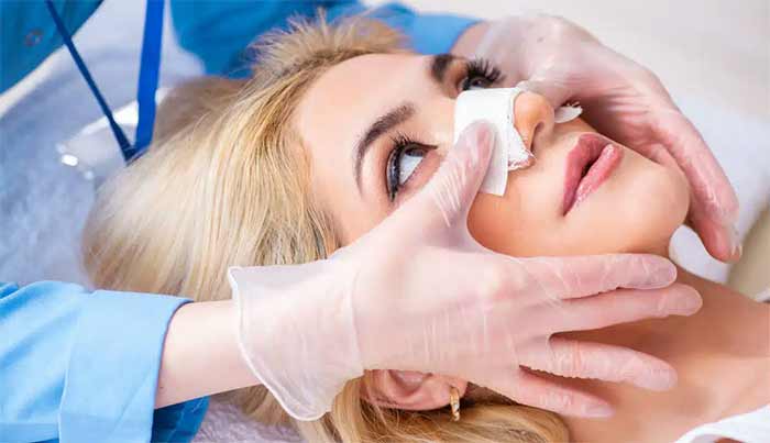 به هوش آمدن عمل بینی