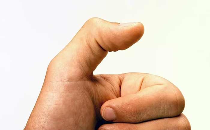 وضعیت انگشت ماشه‌ای