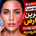 سلامت پوست سلامت پوست | عوارض