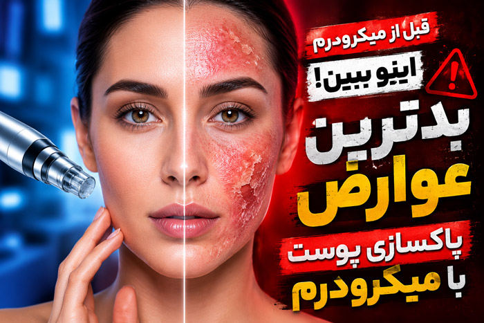 9 بدترین عوارض پاکسازی پوست با میکرودرم (برای خانم ها)