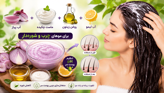 ماسک پیاز + ماست + روغن زیتون (برای موهای چرب و شوره‌دار)