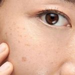 پزشکی | سلامت پوست | مراقبت پوستی