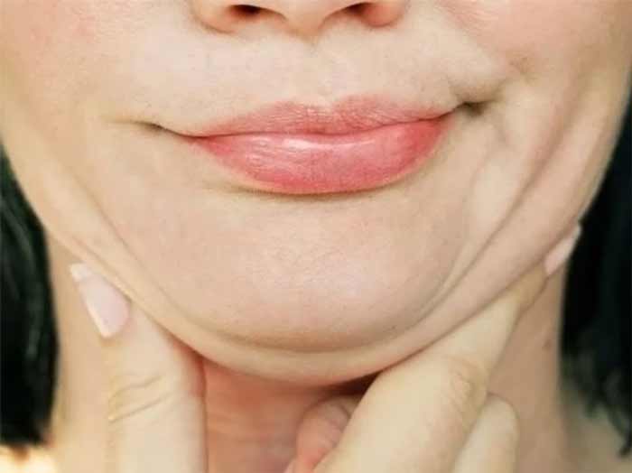 جراحی زیبایی پُف و احتباس آب