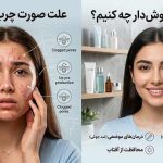 جای جوش جای جوش | صورت | مراقبت از پوست